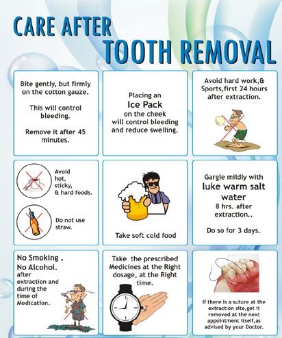 instructions for tooth extraction care